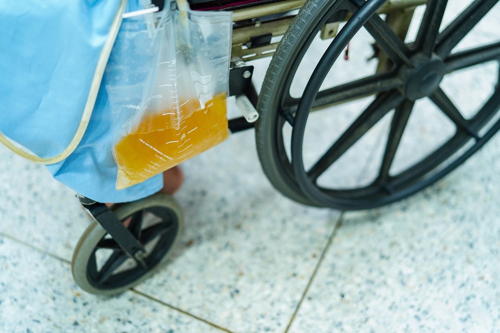 Les poches urinaires jetables vs réutilisables : quelles perspectives pour les entreprises ?